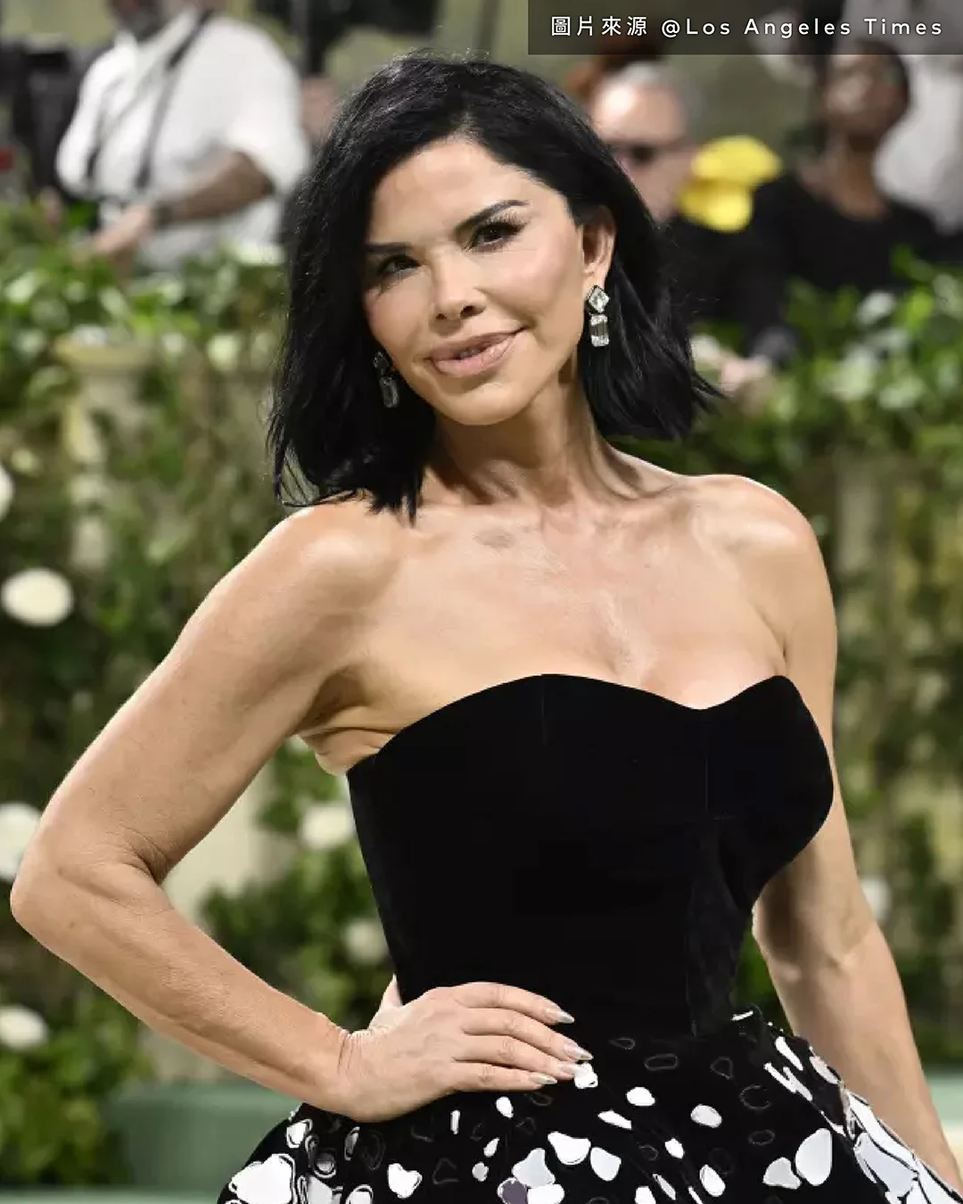 20250709 Lauren Sanchez 的醫美啟示錄 03