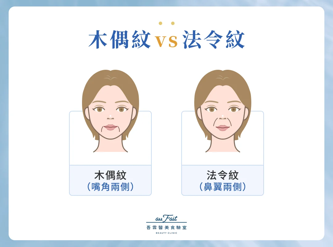 木偶紋 vs 法令紋