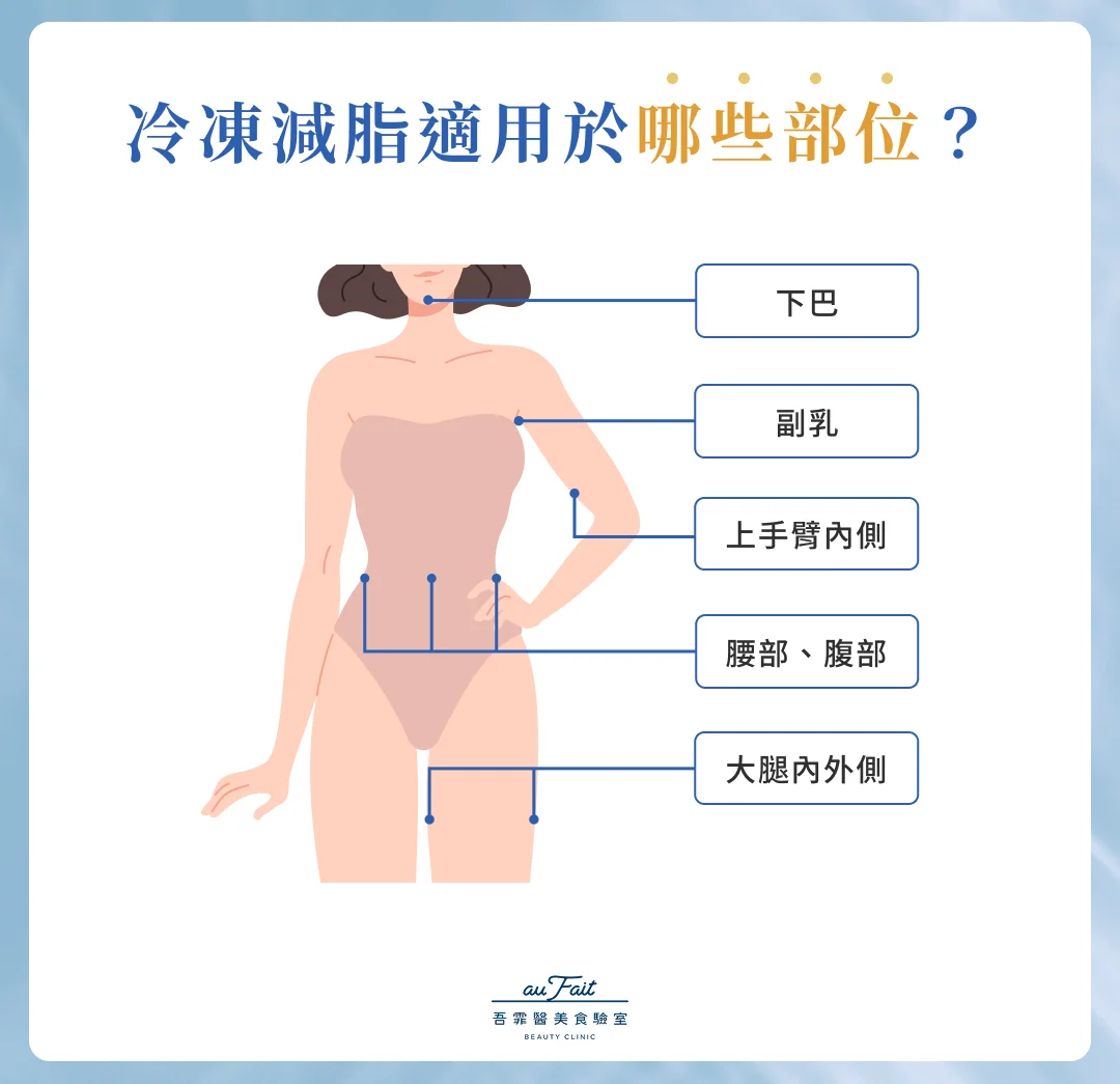 冷凍減脂適用部位