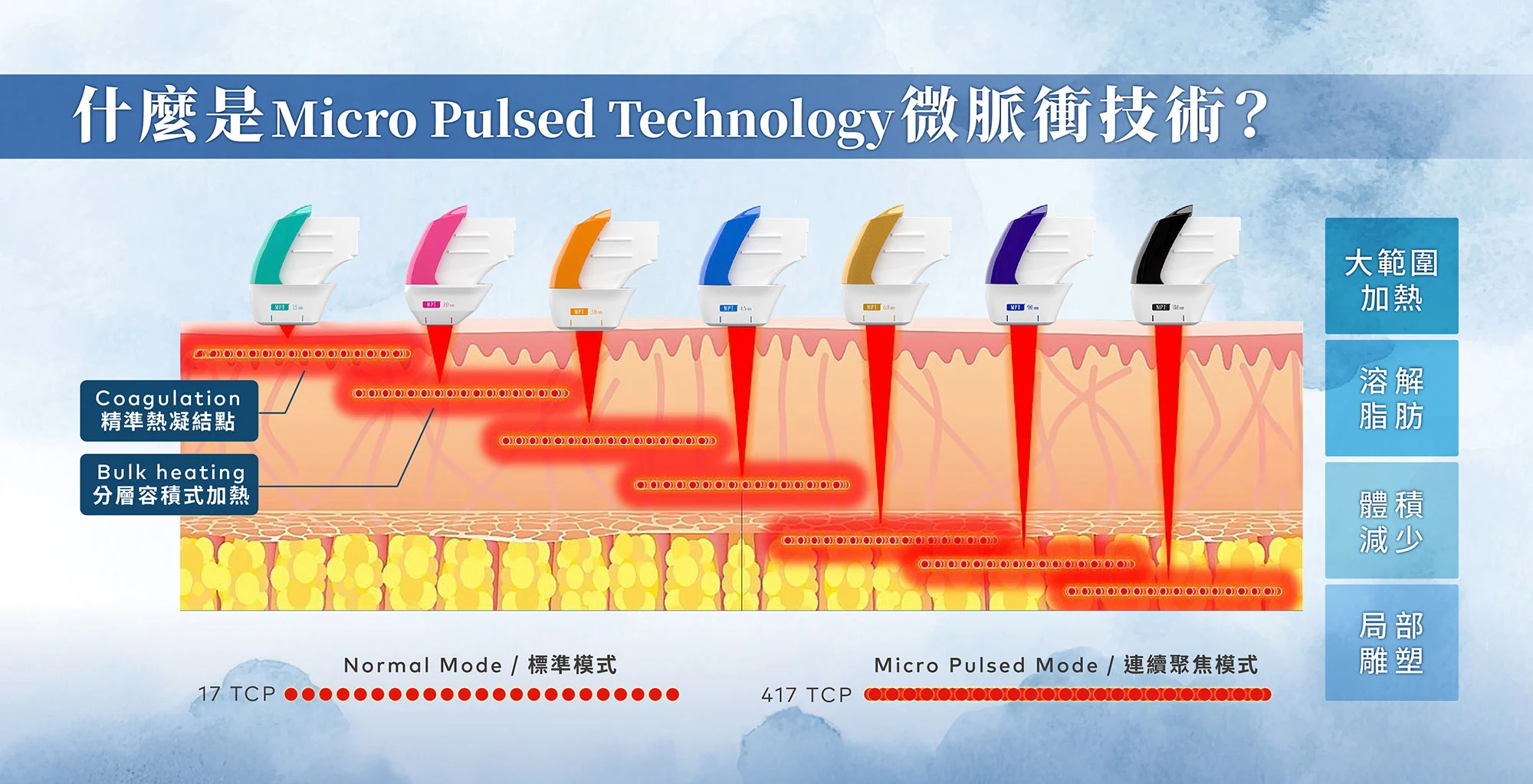 媚必提mpt-MPT是什麼