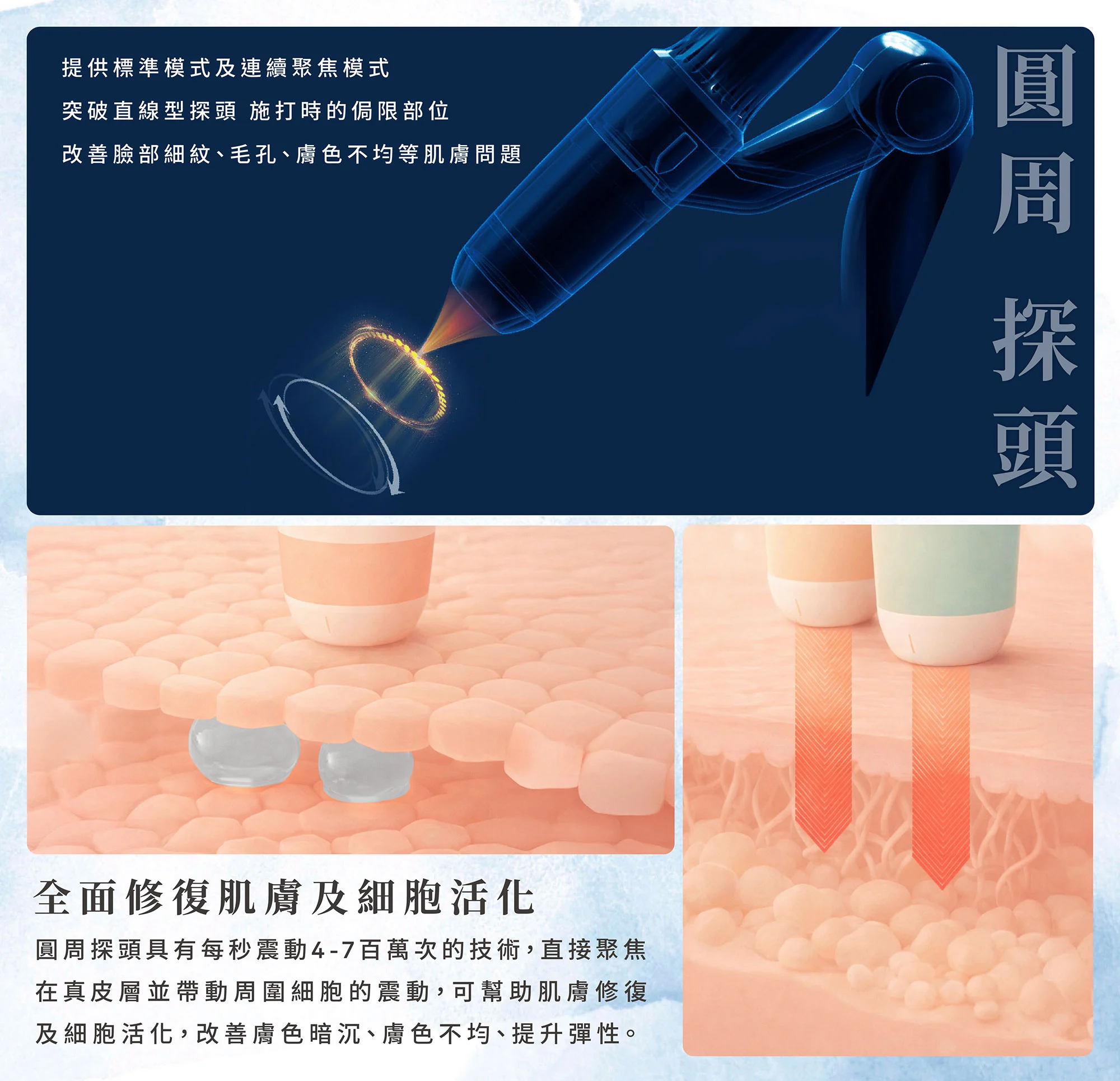 媚必提mpt-圓周探頭