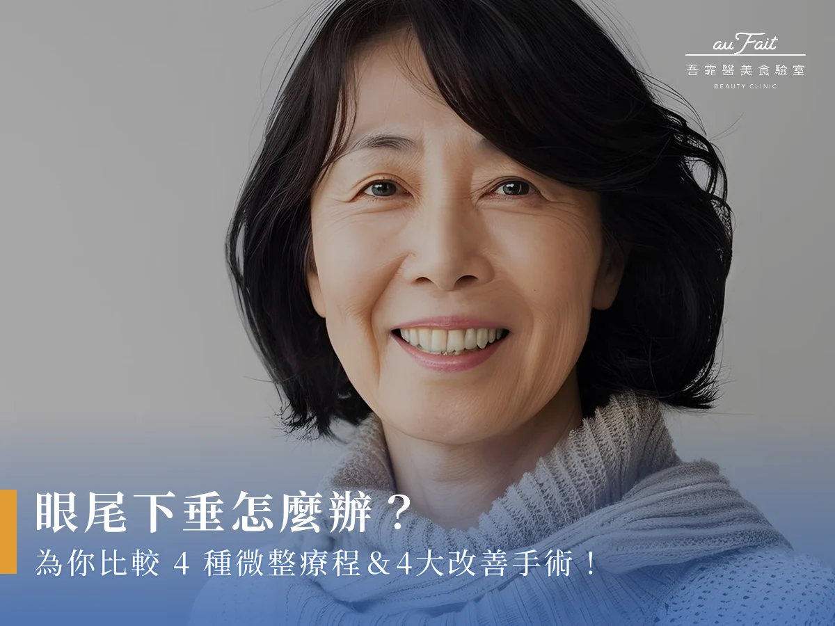 眼尾下垂怎麼辦？為你比較4種微整療程＆4大改善手術！