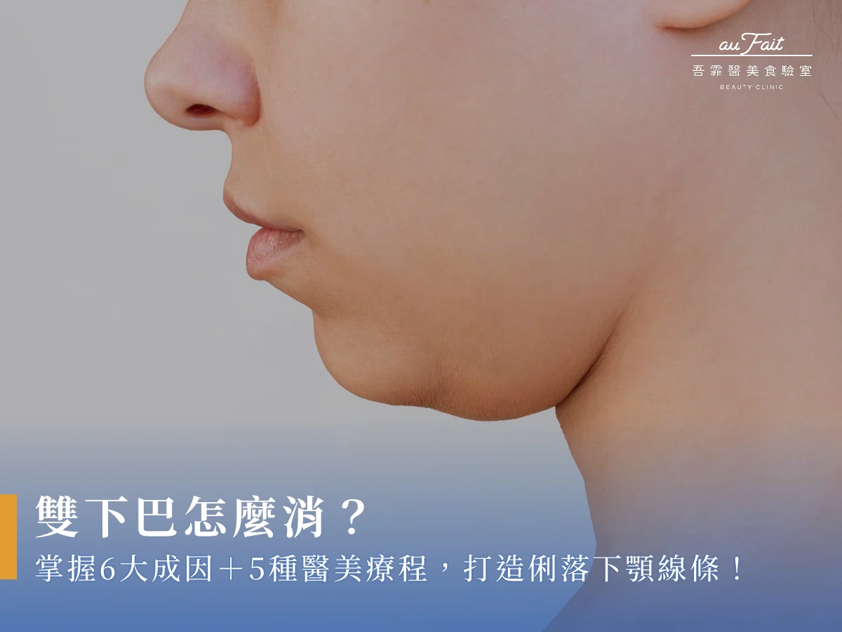 雙下巴怎麼消？掌握6大成因＋5種醫美療程，打造俐落下顎線條！